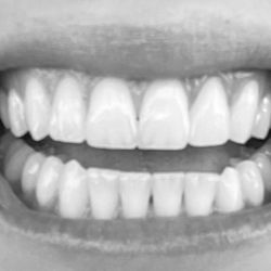 Dentists of Scottsdale - My teeth!