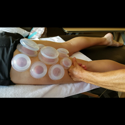 Advanced Perfomance Recovery - Do you suffer from pain or muscle tightness? Cupping relieves muscle tension, increases circulation, and detoxifies the body.