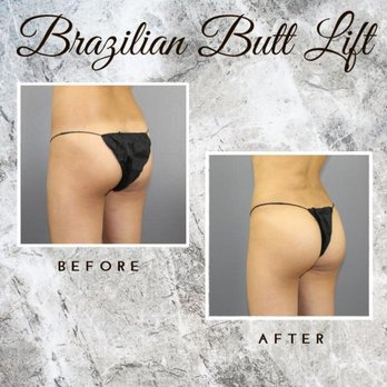 Leo Lapuerta, MD - Cosmetic Surgeons Near Me - Houston, Texas Leo Lapuerta, MD - Cosmetic Surgeons Near Me - Houston, Texas