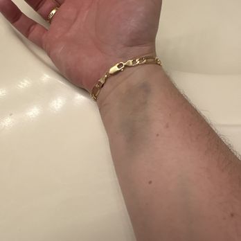 Lake Anesthesia - Pain in my wrist for over a week. - Anesthesiologists Near Me - Flossmoor, Illinois Lake Anesthesia - Pain in my wrist for over a week. - Anesthesiologists Near Me - Flossmoor, Illinois