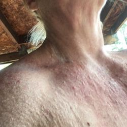 Colorado Springs Dermatology