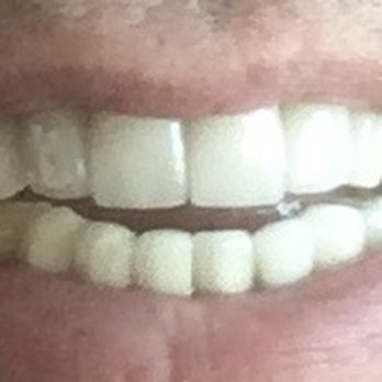 Open Wide Dental - Phoenix - General Dentistry Near Me - Phoenix, Arizona Open Wide Dental - Phoenix - General Dentistry Near Me - Phoenix, Arizona