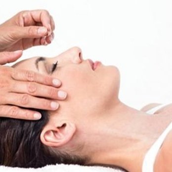 Four Seasons Acupuncture - Cosmetic - Acupuncture Near Me - Sun City, Arizona Four Seasons Acupuncture - Cosmetic - Acupuncture Near Me - Sun City, Arizona