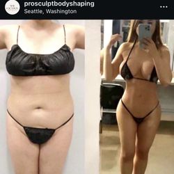 Studio ProSculpt