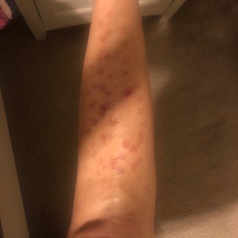 Moran Laser And Salon - It hurt so bad - Tattoo Removal Near Me - Nashville, Tennessee Moran Laser And Salon - It hurt so bad - Tattoo Removal Near Me - Nashville, Tennessee