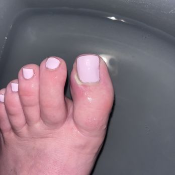 Fashion Nails - Noticed a pus pocket in my toe - Nail Salons Near Me - Quincy, Massachusetts