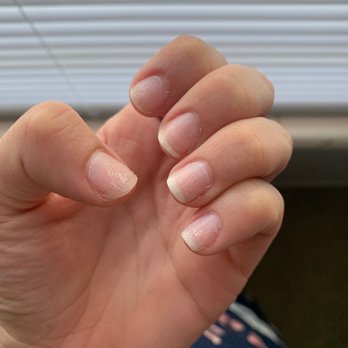 Tiffany's Nail And Spa - What my nails look like directly after she ripped the polish off. I was then told "that's it. You're done". - Nail Salons Near Me - Gainesville, Florida Tiffany's Nail And Spa - What my nails look like directly after she ripped the polish off. I was then told "that's it. You're done". - Nail Salons Near Me - Gainesville, Florida