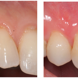 Michael A Wasemiller, DDS - Covering Recession
