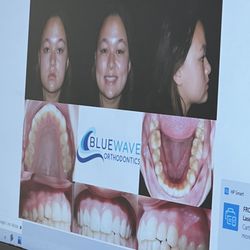 Blue Wave Orthodontics - New digital scans