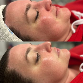 Amla Esthetics - The Holistic Facial - Skin Care Near Me - Long Beach, California Amla Esthetics - The Holistic Facial - Skin Care Near Me - Long Beach, California