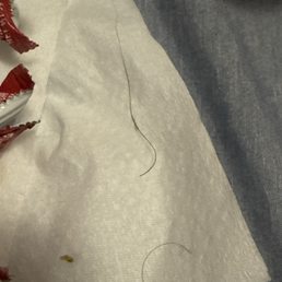 The hairs found after just a few bites in. Bars were found back to back. The hairs found after just a few bites in. Bars were found back to back.