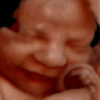 4D Peanut Gallery - Ultrasound Imaging Centers Near Me - Texarkana, Texas 4D Peanut Gallery - Ultrasound Imaging Centers Near Me - Texarkana, Texas