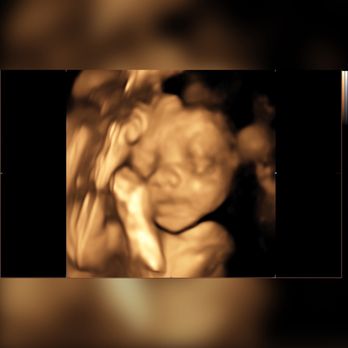 Womb's View - Ultrasound Imaging Centers Near Me - Modesto, California Womb's View - Ultrasound Imaging Centers Near Me - Modesto, California
