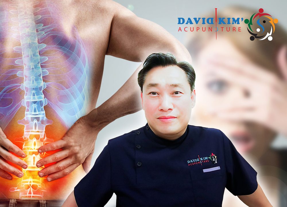 DAVID KIM’S ACUPUNCTURE - Updated February 2026 - 12 Photos & 24 ...