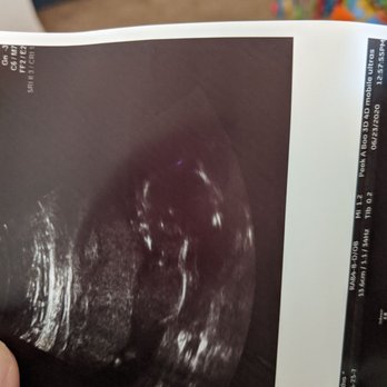 Peek A Boo - Ultrasound Imaging Centers Near Me - Hesperia, California