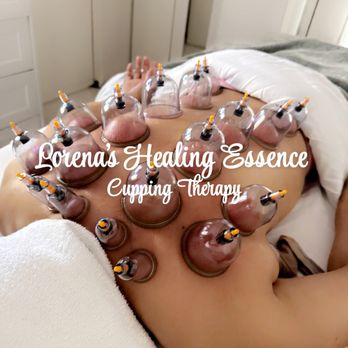 Lorena’s Healing Essence - Cupping / Vensosas - Body Contouring Near Me - Redwood City, California Lorena’s Healing Essence - Cupping / Vensosas - Body Contouring Near Me - Redwood City, California