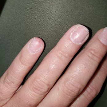 Epic Nails & Spa - Acrylic nails ripped off, painful raw skin. Avoid Epic Nails!!! - Nail Salons Near Me - Southington, Connecticut