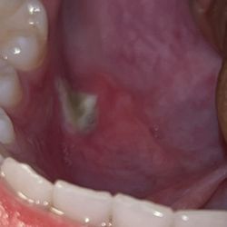 Adventure - Inside mouth