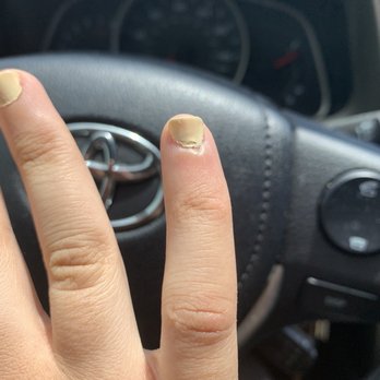 Centre Pointe Nails & Spa - Manicure with cut skin - Nail Salons Near Me - Phoenix, Arizona Centre Pointe Nails & Spa - Manicure with cut skin - Nail Salons Near Me - Phoenix, Arizona