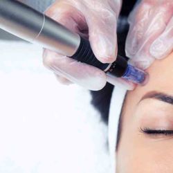 Guilliard's Beauty - Advanced Skin Care Treatments including microneedling