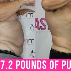 Fast Fit Body Sculpting - Fast Fit Body Sculpting Fat Weight Loss Review Before and After Skin Tightening