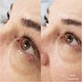 Photo of Paru Threading
