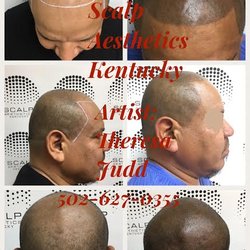 A Permanent Solution: Permanent Cosmetics By Theresa - Before & After Scalp Micropigmentation Call 201-970-3244 for your free no obligation consultation.