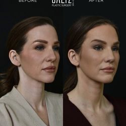 Saltz Plastic Surgery & Saltz Spa Vitoria