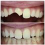 Elevate Dental