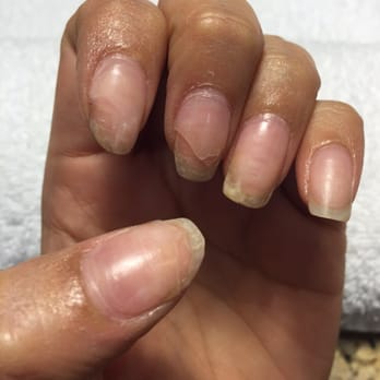 Allure Nail Spa - These nails were done March 12th 2015 and chipped off on both hands one day later. - Nail Salons Near Me - Chicago, Illinois