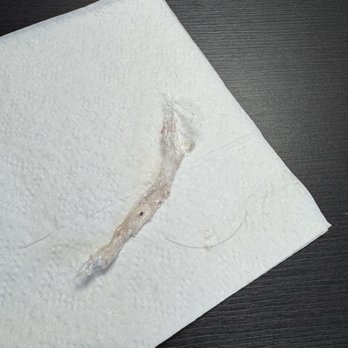Honey-Jam Cafe - A piece of plastic wrap and someone's hair! - Breakfast & Brunch Near Me - Arlington Heights, Illinois