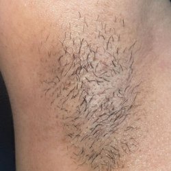 Drip Wax By E - Underarm wax