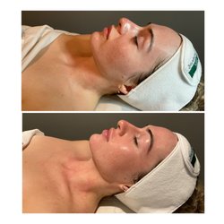 Sand and Sea Spa - DMK Enzyme Treatment "Bring everything back to balance "