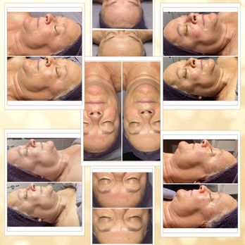 Skincare By Tanya - 75-min Signature Facial: reduced redness, softened fine lines & wrinkles, brighter, radiant complexion.
#SkincareByTanya #417facials - Skin Care Near Me - Springfield, Missouri Skincare By Tanya - 75-min Signature Facial: reduced redness, softened fine lines & wrinkles, brighter, radiant complexion.
#SkincareByTanya #417facials - Skin Care Near Me - Springfield, Missouri