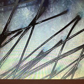 Vy’s Beauty Lounge - My scalp with a microscopic view of my hair follicles. - Eyelash Service Near Me - Vacaville, California Vy’s Beauty Lounge - My scalp with a microscopic view of my hair follicles. - Eyelash Service Near Me - Vacaville, California
