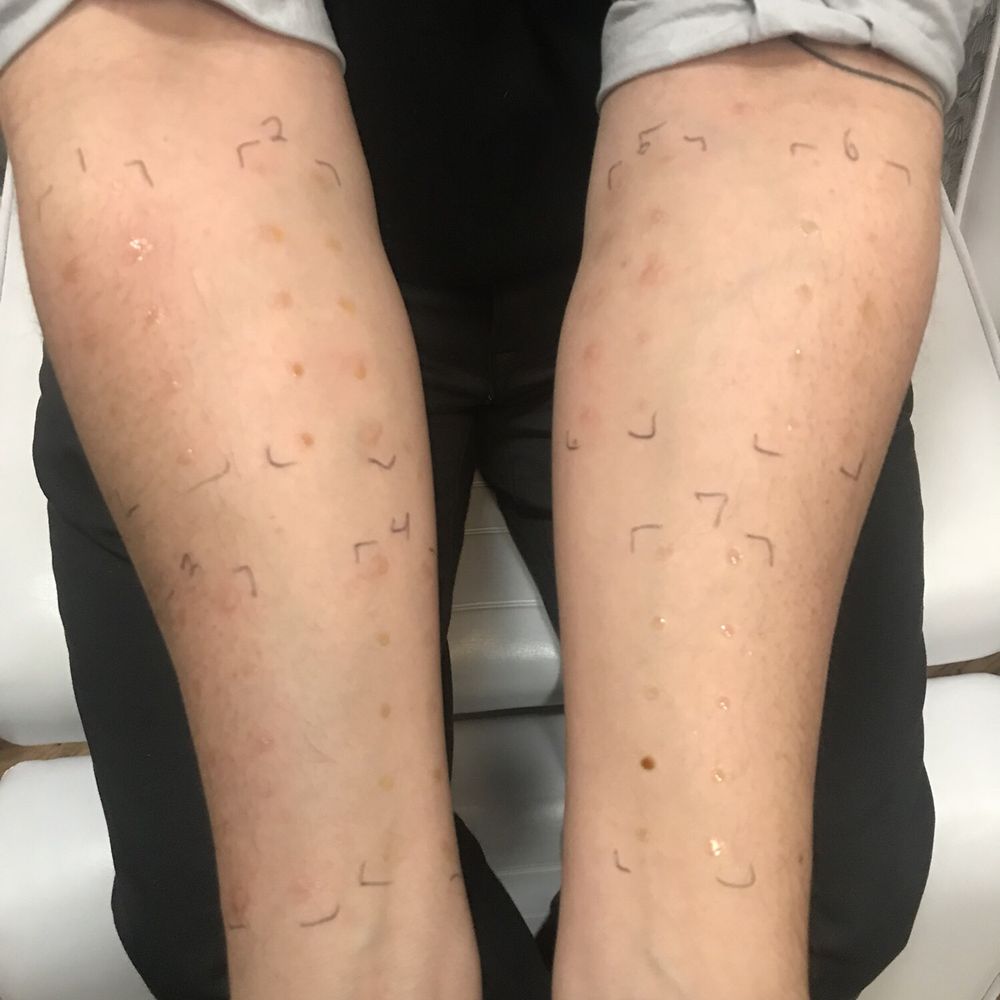 Hudson Allergy - Allergists Near Me - New York, New York Hudson Allergy - Allergists Near Me - New York, New York