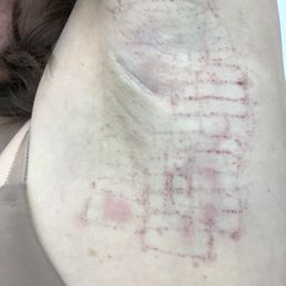 30 minutes after treatment:) 30 minutes after treatment:)