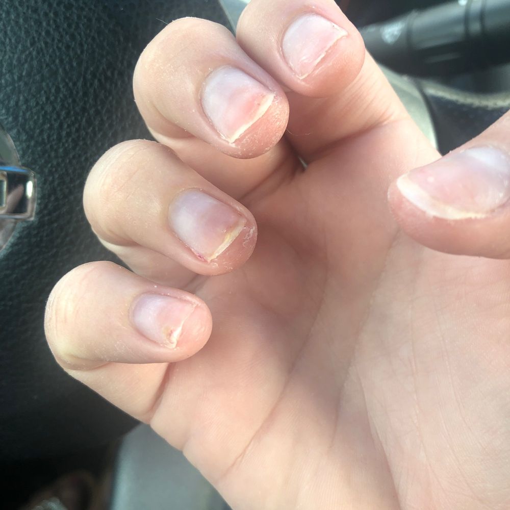 Blue Water Nails & Spa - Here is a photo of the nails that cost me $95. This please is horrendous never go here - Nail Salons Near Me - Orlando, Florida