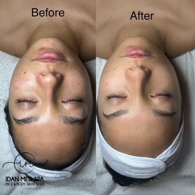 Idan Med Spa by null