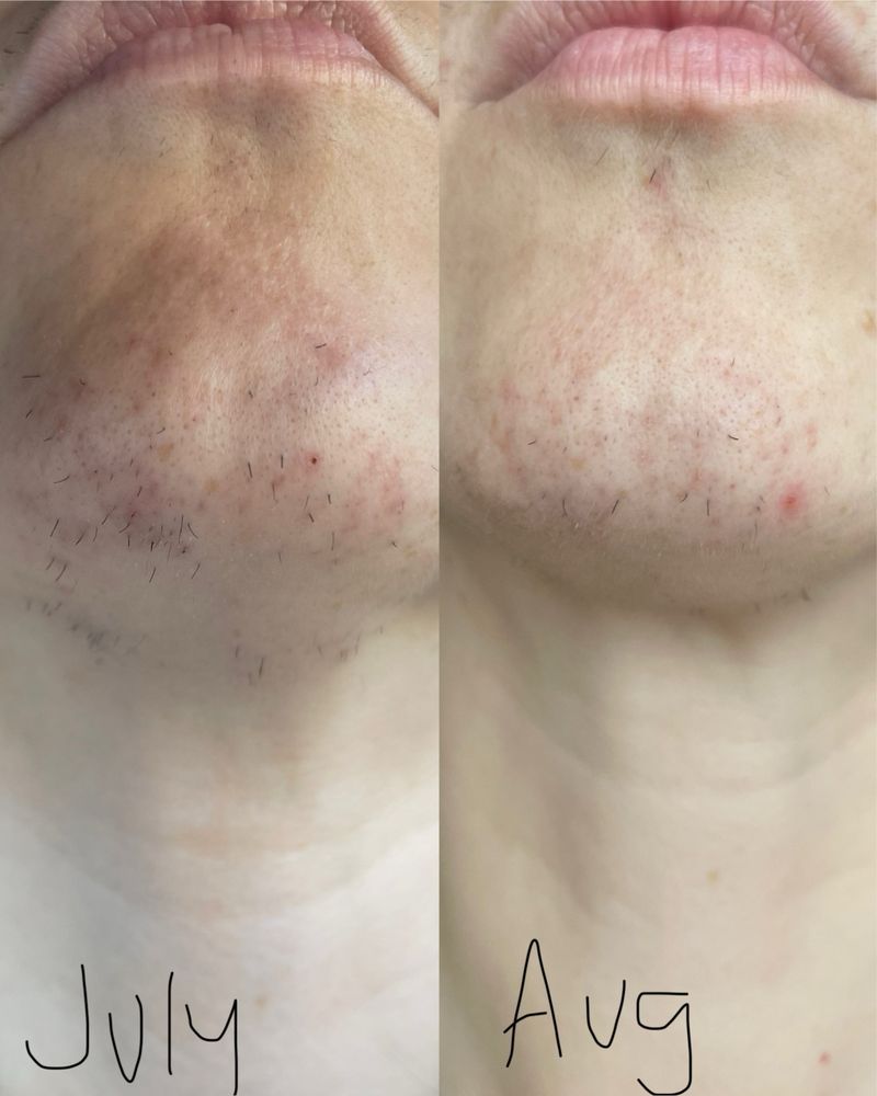 IDEAL ELECTROLYSIS with photos Updated August 2024 51 Photos & 66