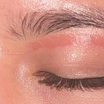 J’adore Nail Lounge - 2nd degree burn from eyebrow waxing. - Nail Salons Near Me - Escondido, California J’adore Nail Lounge - 2nd degree burn from eyebrow waxing. - Nail Salons Near Me - Escondido, California