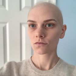 I had my brows microbladed in anticipation of chemo hair loss. Eight weeks in and they still look great.