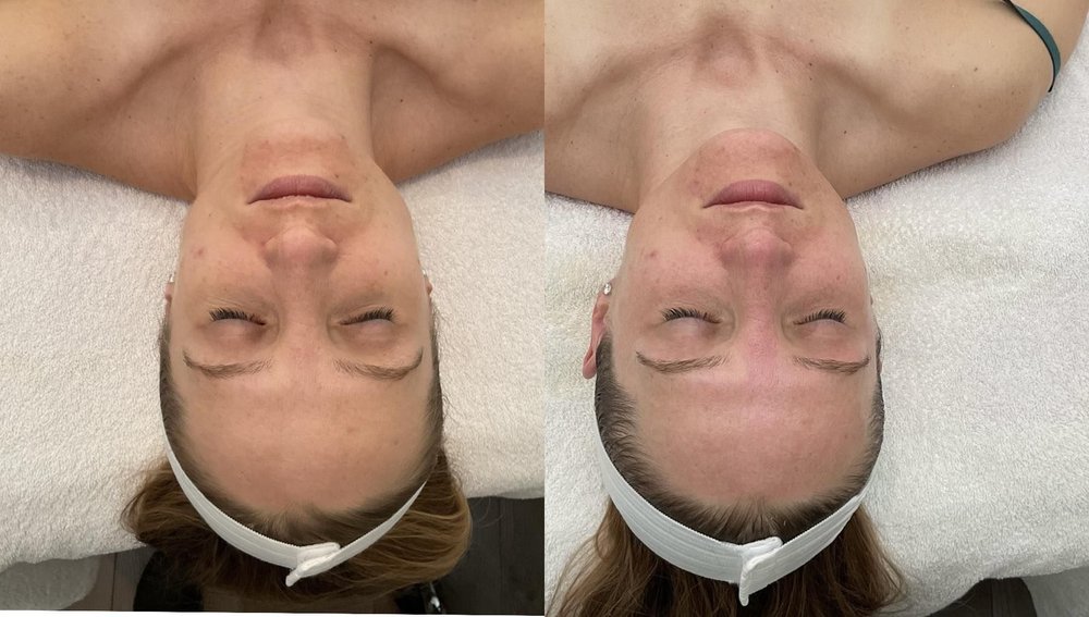 Caprice Beauty Aesthetic 