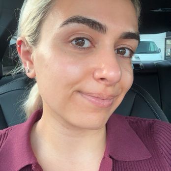 Facialworks - HydraFacial results - Skin Care Near Me - Newport Beach, California Facialworks - HydraFacial results - Skin Care Near Me - Newport Beach, California
