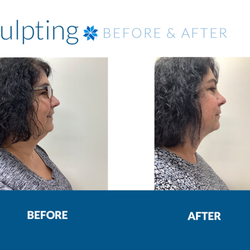 Apex Dermatology Medina