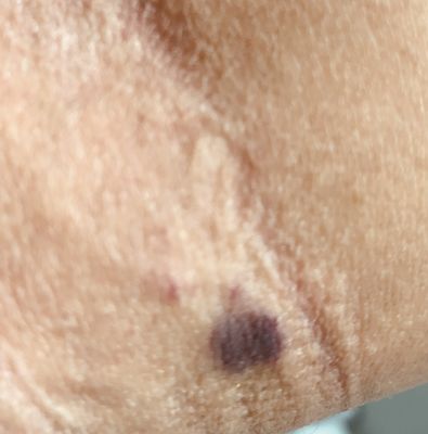 Brigham and Women's Hospital by null