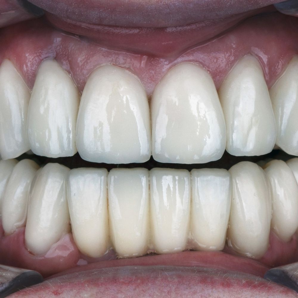 NASSAU DENTAL 13 Photos 95 Clinton St, Hempstead, New York