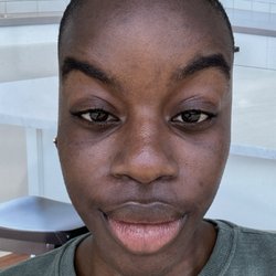 Post jet peel facial glow