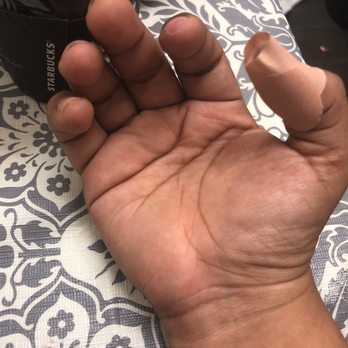 PG Nails & Spa - My skin peeling off. - Nail Salons Near Me - Hyattsville, Maryland PG Nails & Spa - My skin peeling off. - Nail Salons Near Me - Hyattsville, Maryland