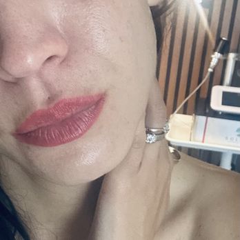Kate Yuka Esthetician  - me after the procedure. I am in my late 30s with  no injection etc. The glow is all Kate - Eyebrow Services Near Me - Costa Mesa , California